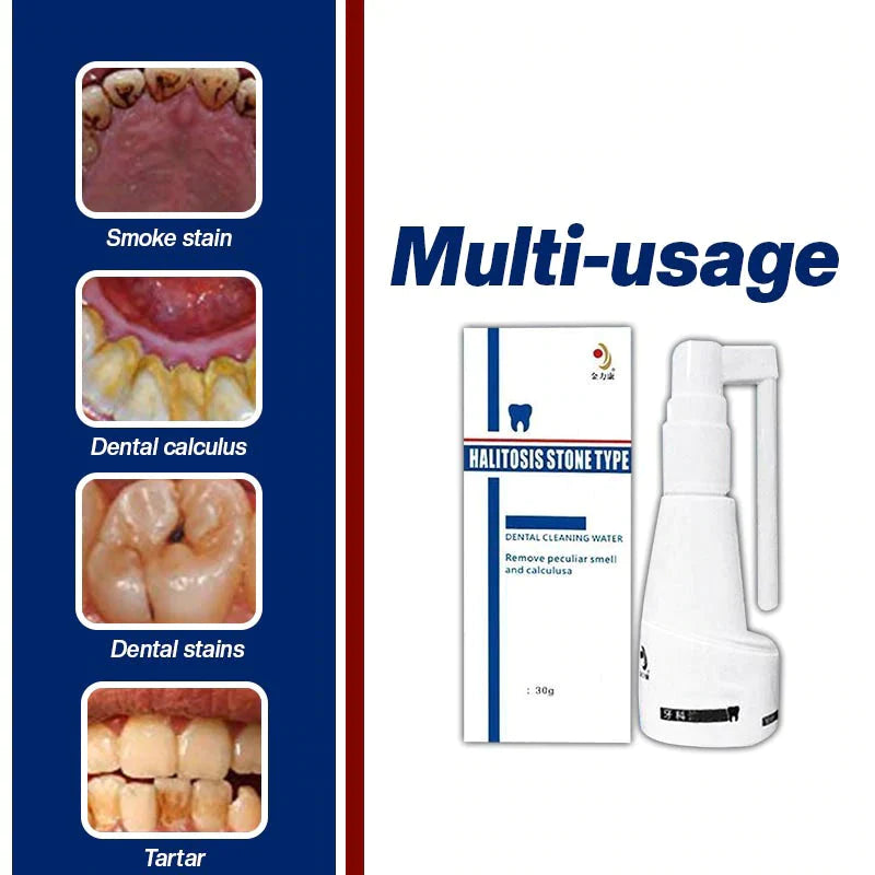 Smile Saver CalculusRemovalSpray【COD + Local Stock !】