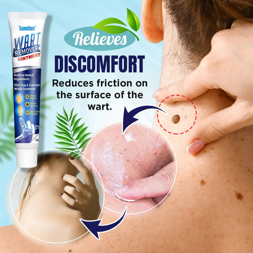 Herbal Wart Treatment Cream【3 Day Delivery&Cash on delivery】