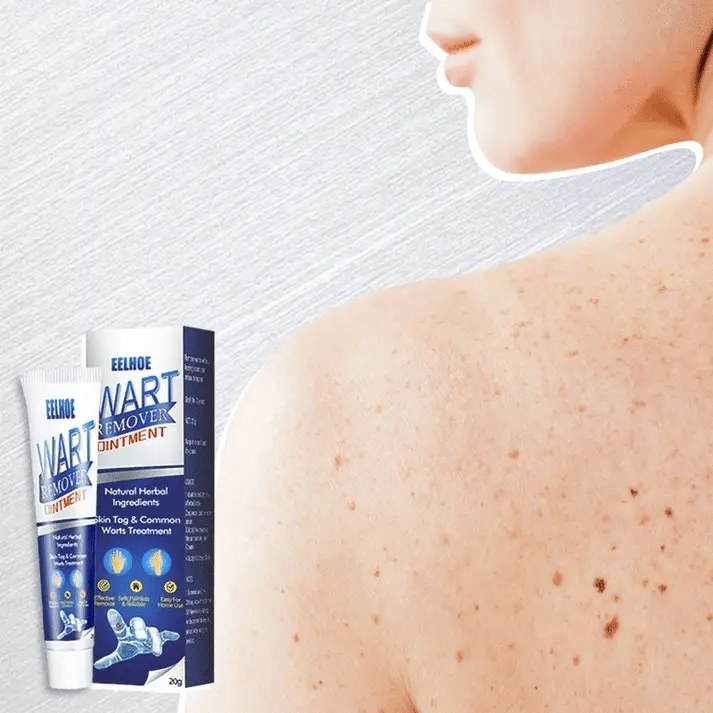 Herbal Wart Treatment Cream【3 Day Delivery&Cash on delivery】